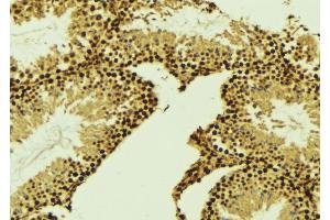 ABIN6269000 at 1/100 staining Mouse testis tissue by IHC-P. (Cyclin E2 anticorps  (C-Term))