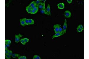 Immunofluorescent analysis of PC-3 cells using ABIN7161366 at dilution of 1:100 and Alexa Fluor 488-congugated AffiniPure Goat Anti-Rabbit IgG(H+L) (NEGR1 anticorps  (AA 1-196))