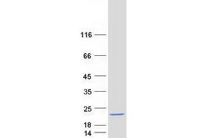Validation with Western Blot