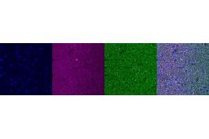 Immunohistochemistry (IHC) image for anti-Insulin-Like Growth Factor Binding Protein 6 (IGFBP6) antibody (ABIN7456279) (IGFBP6 anticorps)