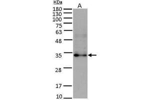 WB Image Sample (15 ug of whole cell lysate) A: HUVEC antibody diluted at 1:5000 (FGF10 anticorps)
