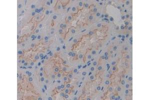 Used in DAB staining on fromalin fixed paraffin- embedded kidney tissue (PLCH2 anticorps  (AA 1-257))