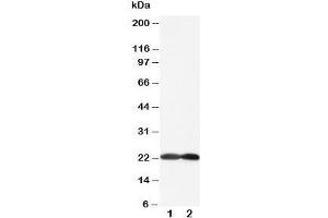 Western blot testing of BAK antibody and Lane 1:  HeLa;  2: rat brain;  Predicted size: 23KD;  Observed size: 23KD