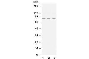 Western blot testing of 1) rat heart, 2) mouse NIH 3T3 and 3) human HeLa lysate with KRIT1 antibody at 0. (KRIT1 anticorps  (AA 703-736))