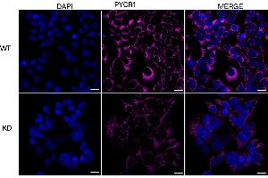 anti-Pyrroline-5-Carboxylate Reductase 1 (PYCR1) antibody