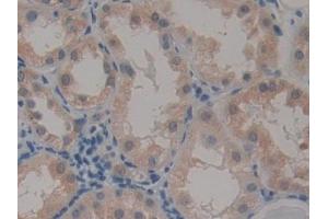 Detection of CARD9 in Human Kidney Tissue using Polyclonal Antibody to Caspase Recruitment Domain Family, Member 9 (CARD9)