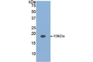 Detection of Recombinant PLAA, Human using Polyclonal Antibody to Phospholipase A2 Activating Protein (PLAP) (PLAA anticorps  (AA 162-312))