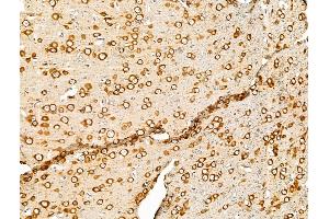 ABIN7094672 and ABIN7098723 at 1/100 staining Rat brain tissue by IHC-P. (PURA anticorps  (Internal Region))