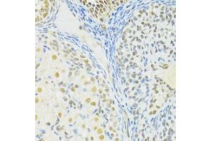 Immunohistochemistry of paraffin-embedded rat ovary using BRCA1 antibody (ABIN6291827) at dilution of 1:100 (40x lens). (BRCA1 anticorps)