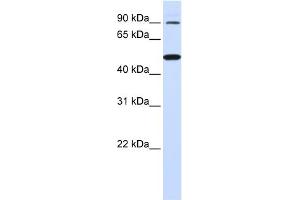 WB Suggested Anti-RHBDF1 Antibody Titration:  0. (RHBDF1 anticorps  (N-Term))