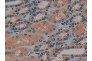 Detection of SNCG in Human Kidney Tissue using Polyclonal Antibody to Gamma-synuclein (SNCG)