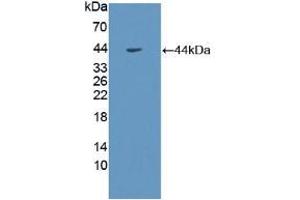 Western blot analysis of recombinant Human GHR. (Growth Hormone Receptor anticorps  (AA 315-574))