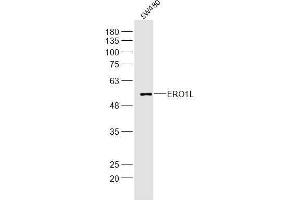 SW480 lysates probed with ERO1L Polyclonal Antibody, Unconjugated  at 1:300 dilution and 4˚C overnight incubation. (ERO1L anticorps  (AA 321-420))