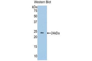 Western Blotting (WB) image for anti-Homogentisate 1,2-Dioxygenase (HGD) (AA 8-205) antibody (ABIN1176266) (HGD anticorps  (AA 8-205))