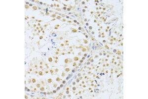Immunohistochemistry of paraffin-embedded mouse testis using AKT1 antibody (ABIN5997218) at dilution of 1/100 (40x lens). (AKT1 anticorps)