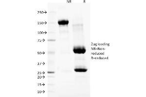 SDS-PAGE Analysis Purified Nuclear Membrane Marker Mouse Monoclonal Antibody (NM97). (Nuclear Membrane Marker anticorps)