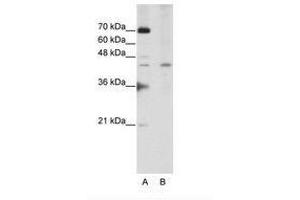 Image no. 3 for anti-Surfeit 6 (SURF6) (AA 191-240) antibody (ABIN202343) (SURF6 anticorps  (AA 191-240))