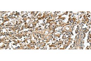 Immunohistochemistry of paraffin-embedded Human tonsil tissue using RAB23 Polyclonal Antibody at dilution of 1:50(x200)