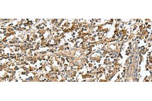 Immunohistochemistry of paraffin-embedded Human tonsil tissue using RAB23 Polyclonal Antibody at dilution of 1:50(x200) (RAB23 anticorps)