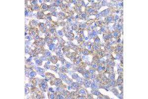 Immunohistochemistry of paraffin-embedded mouse liver using CCBL1 antibody at dilution of 1:100 (x40 lens). (CCBL1 anticorps)