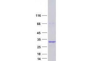 Validation with Western Blot