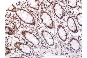 Image no. 1 for anti-Suppressor of Cytokine Signaling 3 (SOCS3) (AA 1-226) antibody (ABIN465973)