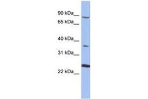 Image no. 1 for anti-Membrane Protein, Palmitoylated 3 (MAGUK P55 Subfamily Member 3) (MPP3) (AA 35-84) antibody (ABIN6744048) (MPP3 anticorps  (AA 35-84))