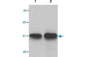 Western blot analysis of ZIP9 in HepG2 cell lysate with SLC39A9 polyclonal antibody  at 1 ug/mL (lane 1) and 2 ug/mL (lane 2). (SLC39A9 anticorps  (N-Term))