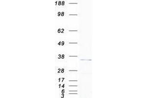 Validation with Western Blot