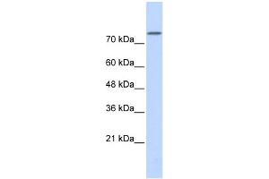 WB Suggested Anti-PLD2 Antibody Titration:  0. (Phospholipase D2 anticorps  (Middle Region))