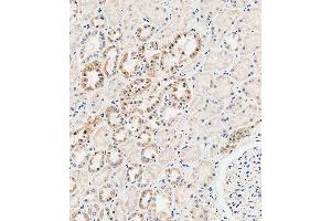Immunohistochemical analysis of paraffin-embedded human kidney tissue using B performed on the Leica® BOND RXm. (MUC20 anticorps  (C-Term))