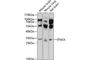 Western blot analysis of extracts of various cell lines, using ITM2A antibody (ABIN6128106, ABIN6142603, ABIN6142604 and ABIN6214624) at 1:1000 dilution. (ITM2A anticorps  (AA 1-263))