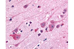 Anti-DRD1 antibody IHC of human brain.