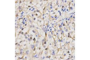 Immunohistochemistry (IHC) image for anti-Protein Phosphatase 2A Activator, Regulatory Subunit 4 (PPP2R4) antibody (ABIN1874229) (PPP2R4 anticorps)