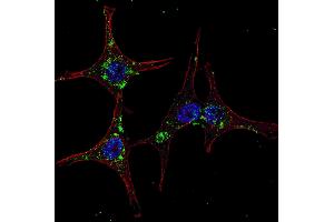 Fluorescent confocal image of HeLa cells stained with SYVN1 (HRD1) antibody. (SYVN1 anticorps  (C-Term))