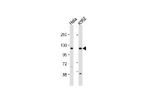 Western Blot at 1:1000 dilution Lane 1: Hela whole cell lysate Lane 2: K562 whole cell lysate Lysates/proteins at 20 ug per lane. (DDX11 anticorps  (C-Term))