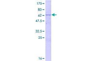 Image no. 1 for Deoxynucleotidyltransferase, Terminal, Interacting Protein 1 (DNTTIP1) (AA 1-329) protein (GST tag) (ABIN1351879)