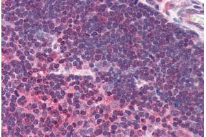 Human Thymus (formalin-fixed, paraffin-embedded) stained with UNC13D antibody ABIN290189 at 2. (UNC13D anticorps  (AA 967-980))