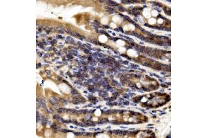 IHC analysis of IRF3 using anti-IRF3 antibody (ABIN7599373).