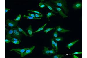 Immunofluorescence of monoclonal antibody to HECTD2 on HeLa cell. (HECTD2 anticorps  (AA 331-440))
