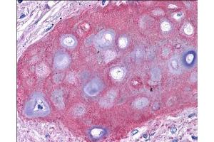 Image no. 2 for anti-Collagen, Type II (COL2) antibody (ABIN2137989) (COL2 anticorps)