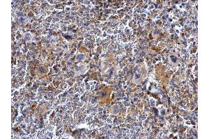 IHC-P Image BTK antibody [C1C3] detects BTK protein at cytosol on mouse spleen by immunohistochemical analysis.