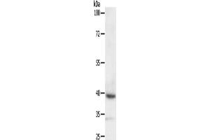 Gel: 10 % SDS-PAGE, Lysate: 40 μg, Lane: SKOV3 cells, Primary antibody: ABIN7129267(DTX3 Antibody) at dilution 1/200, Secondary antibody: Goat anti rabbit IgG at 1/8000 dilution, Exposure time: 10 minutes (Deltex Homolog 3 anticorps)
