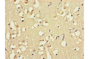 Immunohistochemistry of paraffin-embedded human brain tissue using ABIN7152623 at dilution of 1:100