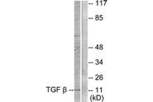 Western blot analysis of extracts from COS7 cells, using TGF beta3 Antibody. (TGFB3 anticorps  (AA 261-310))