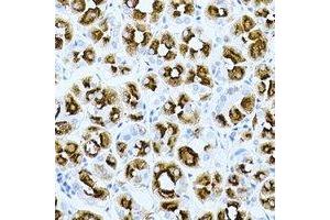 Immunohistochemical analysis of GHRH staining in human gastric cancer formalin fixed paraffin embedded tissue section. (GHRH anticorps)