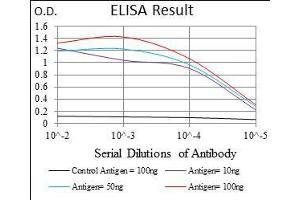 Black line: Control Antigen (100 ng), Purple line: Antigen(10 ng), Blue line: Antigen (50 ng), Red line: Antigen (100 ng), (ADRP anticorps  (AA 286-437))