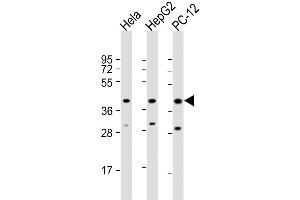 Western Blot at 1:2000 dilution Lane 1: Hela whole cell lysate Lane 2: HepG2 whole cell lysate Lane 3: PC-12 whole cell lysate Lysates/proteins at 20 ug per lane. (MAPK14 anticorps  (AA 301-330))