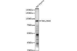 Western blot analysis of extracts of Rat thymus, using TBK1/NAK antibody (ABIN3016267, ABIN3016268, ABIN3016269 and ABIN6219678) at 1:1000 dilution. (TBK1 anticorps  (AA 440-729))