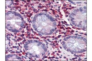 AP22453PU-N TRIM21 antibody staining of Formalin-Fixed, Paraffin-Embedded Human Colon at 5 µg/ml using Biotin conjugated anti-Goat IgG secondary antibody, Alkaline Phosphatase-Streptavidin and Chromogen. (TRIM21 anticorps  (C-Term))